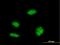 KH-Type Splicing Regulatory Protein antibody, H00008570-M03, Novus Biologicals, Immunocytochemistry image 