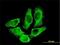 Creatine Kinase, M-Type antibody, H00001158-M02, Novus Biologicals, Immunocytochemistry image 