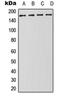 Drosha Ribonuclease III antibody, orb215146, Biorbyt, Western Blot image 