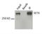 Senataxin antibody, NBP1-94712, Novus Biologicals, Western Blot image 