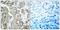 Mitogen-Activated Protein Kinase Kinase 6 antibody, GTX50204, GeneTex, Immunohistochemistry paraffin image 