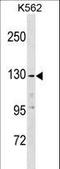 Epidermal Growth Factor antibody, LS-C159513, Lifespan Biosciences, Western Blot image 