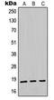 Midkine antibody, LS-C352501, Lifespan Biosciences, Western Blot image 