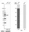 SRC Proto-Oncogene, Non-Receptor Tyrosine Kinase antibody, NBP2-38165, Novus Biologicals, Western Blot image 