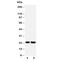 Fibroblast Growth Factor 9 antibody, R30525, NSJ Bioreagents, Western Blot image 