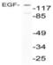 Epidermal Growth Factor antibody, NBP1-19806, Novus Biologicals, Western Blot image 