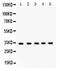 Estrogen Receptor Binding Site Associated Antigen 9 antibody, PB9553, Boster Biological Technology, Western Blot image 