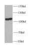 Opioid Growth Factor Receptor antibody, FNab05979, FineTest, Western Blot image 