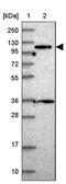 Protein Phosphatase 6 Regulatory Subunit 1 antibody, PA5-60574, Invitrogen Antibodies, Western Blot image 