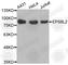 EPS8 Like 2 antibody, A3485, ABclonal Technology, Western Blot image 