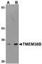 Transmembrane Protein 38B antibody, A09944, Boster Biological Technology, Western Blot image 