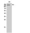 DCC Netrin 1 Receptor antibody, PA5-50946, Invitrogen Antibodies, Western Blot image 