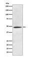 Calcium/Calmodulin Dependent Protein Kinase II Alpha antibody, M03241, Boster Biological Technology, Western Blot image 