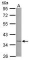 JunD Proto-Oncogene, AP-1 Transcription Factor Subunit antibody, PA5-27624, Invitrogen Antibodies, Western Blot image 