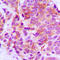 STEAP4 Metalloreductase antibody, LS-C368531, Lifespan Biosciences, Immunohistochemistry paraffin image 