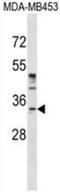 POU Class 6 Homeobox 1 antibody, AP53401PU-N, Origene, Western Blot image 