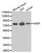 Hedgehog Interacting Protein antibody, MBS129042, MyBioSource, Western Blot image 