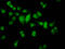 H6 Family Homeobox 2 antibody, LS-C680607, Lifespan Biosciences, Immunofluorescence image 