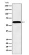 Stress Induced Phosphoprotein 1 antibody, M02683, Boster Biological Technology, Western Blot image 