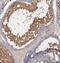 ADP-Ribosylhydrolase Like 2 antibody, FNab00544, FineTest, Immunohistochemistry frozen image 