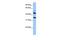 Interleukin 13 Receptor Subunit Alpha 2 antibody, GTX45499, GeneTex, Western Blot image 