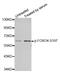 Forkhead Box O4 antibody, STJ22147, St John