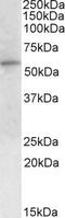 Glucose-6-Phosphate Dehydrogenase antibody, PA5-18726, Invitrogen Antibodies, Western Blot image 