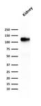 Cadherin 16 antibody, GTX34582, GeneTex, Western Blot image 