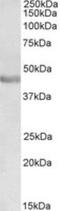 Paired Box 3 antibody, NB100-1420, Novus Biologicals, Western Blot image 