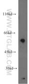 Ectonucleotide Pyrophosphatase/Phosphodiesterase 4 antibody, 17305-1-AP, Proteintech Group, Western Blot image 