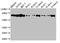 Protein Kinase C Eta antibody, CSB-PA15879A0Rb, Cusabio, Western Blot image 