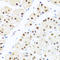 RAB3A Interacting Protein antibody, A09085-1, Boster Biological Technology, Immunohistochemistry paraffin image 