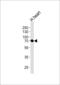 Caseinolytic Mitochondrial Matrix Peptidase Chaperone Subunit antibody, LS-C168856, Lifespan Biosciences, Western Blot image 