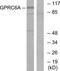 G Protein-Coupled Receptor Class C Group 6 Member A antibody, TA312577, Origene, Western Blot image 