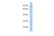 Zinc Finger Protein 585B antibody, PA5-41215, Invitrogen Antibodies, Western Blot image 