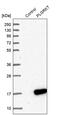 Plasminogen Receptor With A C-Terminal Lysine antibody, PA5-52532, Invitrogen Antibodies, Western Blot image 