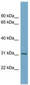 Fibrinogen Like 1 antibody, TA338186, Origene, Western Blot image 