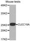 C-Type Lectin Domain Family 18 Member A antibody, abx002589, Abbexa, Western Blot image 
