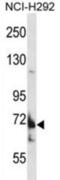 Transmembrane Channel Like 8 antibody, abx027907, Abbexa, Western Blot image 