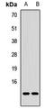 Tumor Protein P53 Regulated Apoptosis Inducing Protein 1 antibody, orb412571, Biorbyt, Western Blot image 