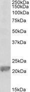 Glutathione peroxidase 1 antibody, EB11666, Everest Biotech, Western Blot image 