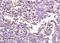 Nucleoporin 160 antibody, orb100640, Biorbyt, Immunohistochemistry paraffin image 