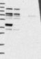 Zinc Finger Protein 518B antibody, NBP1-81379, Novus Biologicals, Western Blot image 