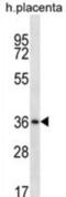 Mitochondrial E3 Ubiquitin Protein Ligase 1 antibody, abx027028, Abbexa, Western Blot image 
