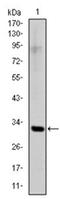 Snail Family Transcriptional Repressor 1 antibody, AM06589SU-N, Origene, Western Blot image 