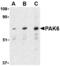 P21 (RAC1) Activated Kinase 6 antibody, MBS150700, MyBioSource, Western Blot image 