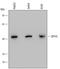 DNA Fragmentation Factor Subunit Alpha antibody, MAB4679, R&D Systems, Western Blot image 