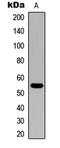 Cytochrome P450 Family 21 Subfamily A Member 2 antibody, abx121381, Abbexa, Western Blot image 