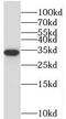 Stanniocalcin 2 antibody, FNab08286, FineTest, Western Blot image 