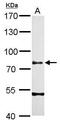 Secretogranin II antibody, PA5-30718, Invitrogen Antibodies, Western Blot image 